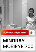 Отзыв на цифровой мобильный рентген Mindray MobiEye 700