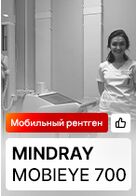 Отзыв на цифровой мобильный рентген Mindray MobiEye 700