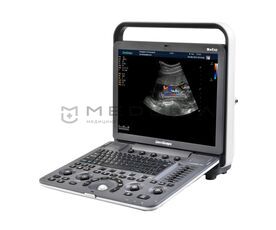 SonoScape S8Exp Vet