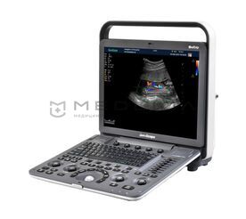 SonoScape S8Exp Vet