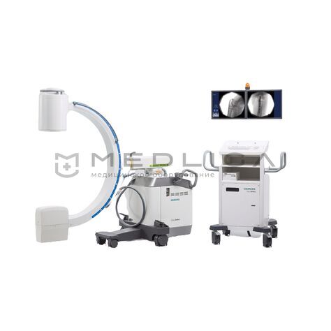 Siemens Cios Select, 3