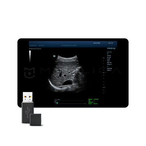 STQ (Sound Touch Quantification)