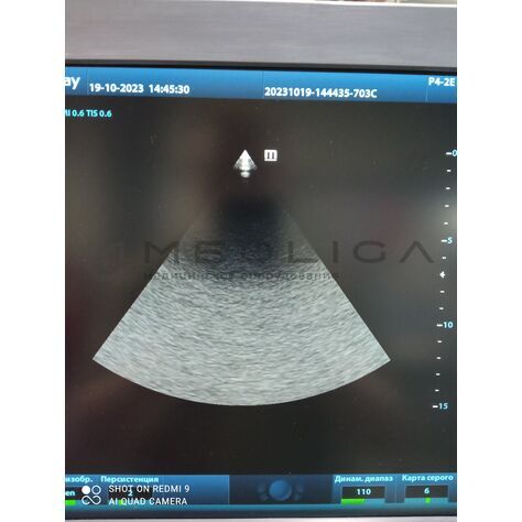 Mindray P4-2E (БУ, 2019), Серийный номер: VSY9B039073, 7