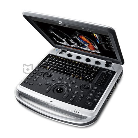 Chison Sonotouch 80 (SonoBook 8)